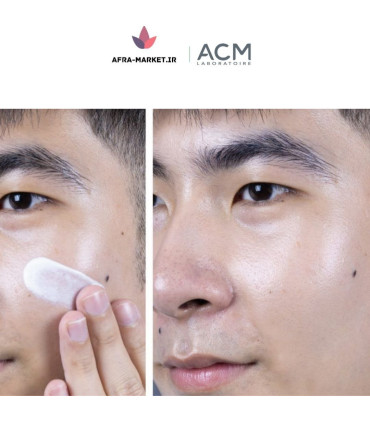 کرم ضدلک دپی وایت ای سی ام ACM
